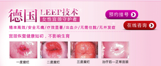 宫颈糜烂